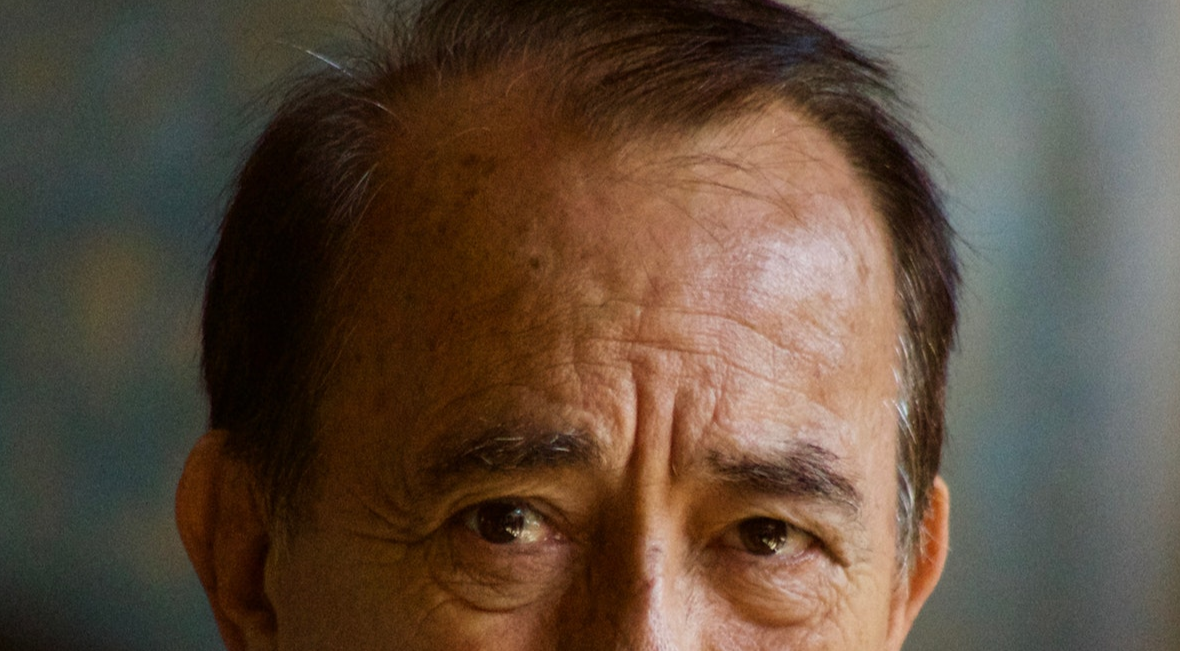 image of old man signifying age spots