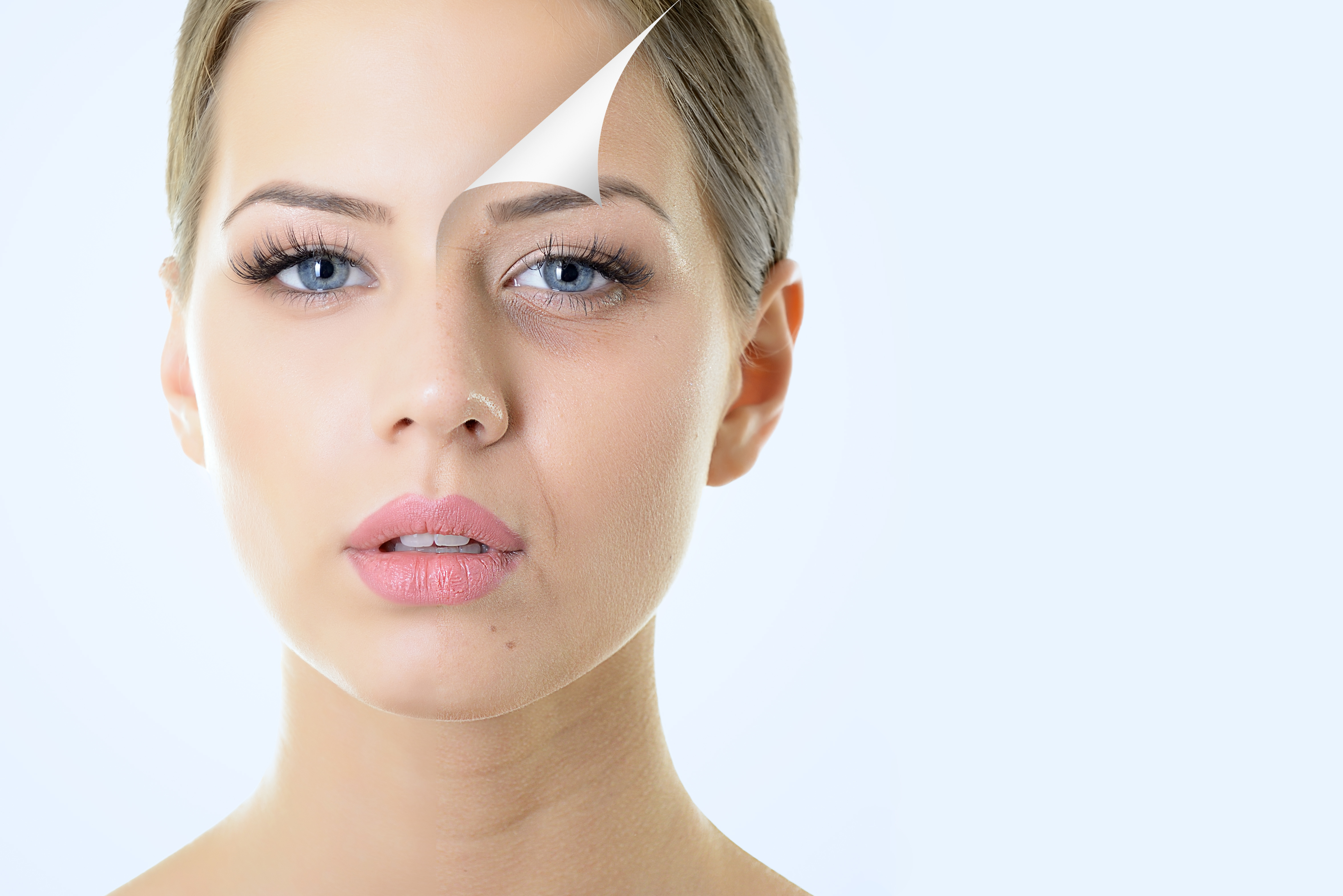 image of a girl highlighting Dull skin