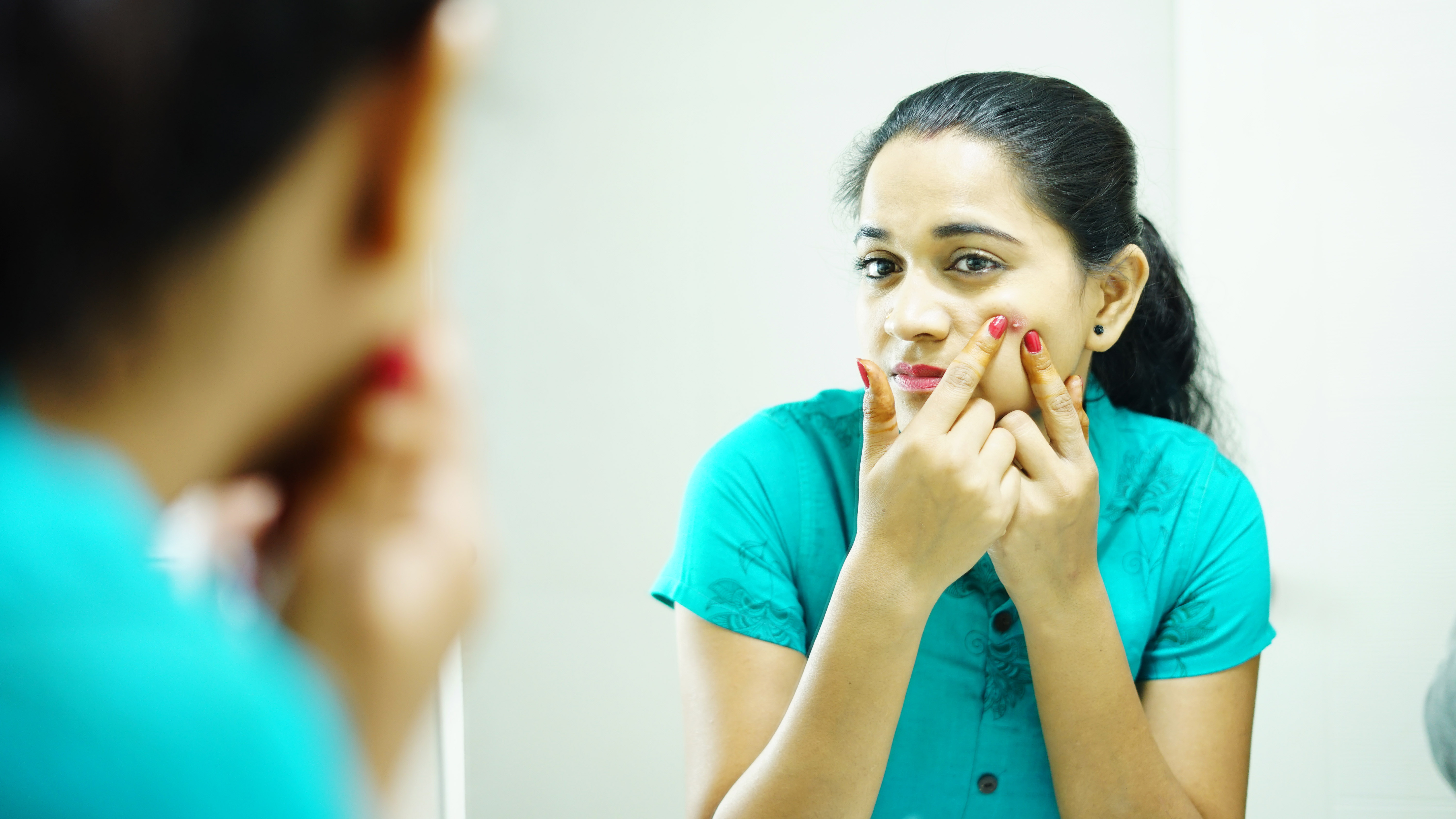 Image of girl having acne