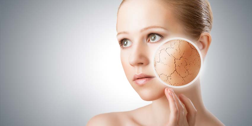 Image illustrating Dry Skin