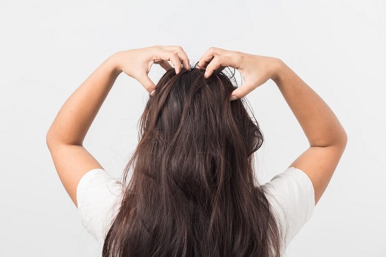 itchy scalp for hair
