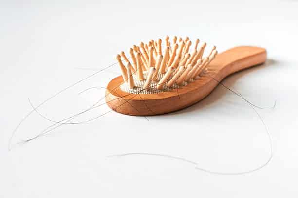 causes for hair loss