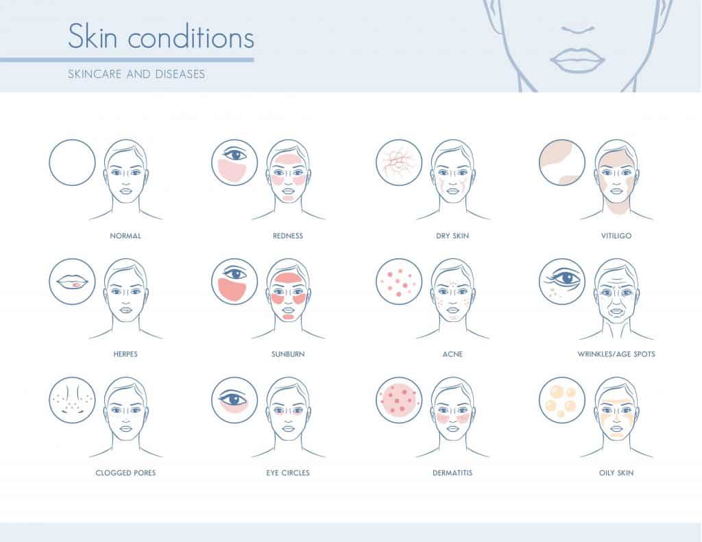 hormones and skin conditions