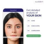 Scan Your Face For Skin Problems Using CureSkin App