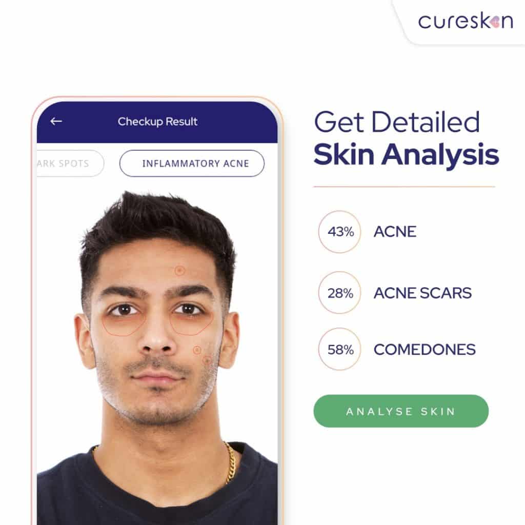 skin analysis cureskin