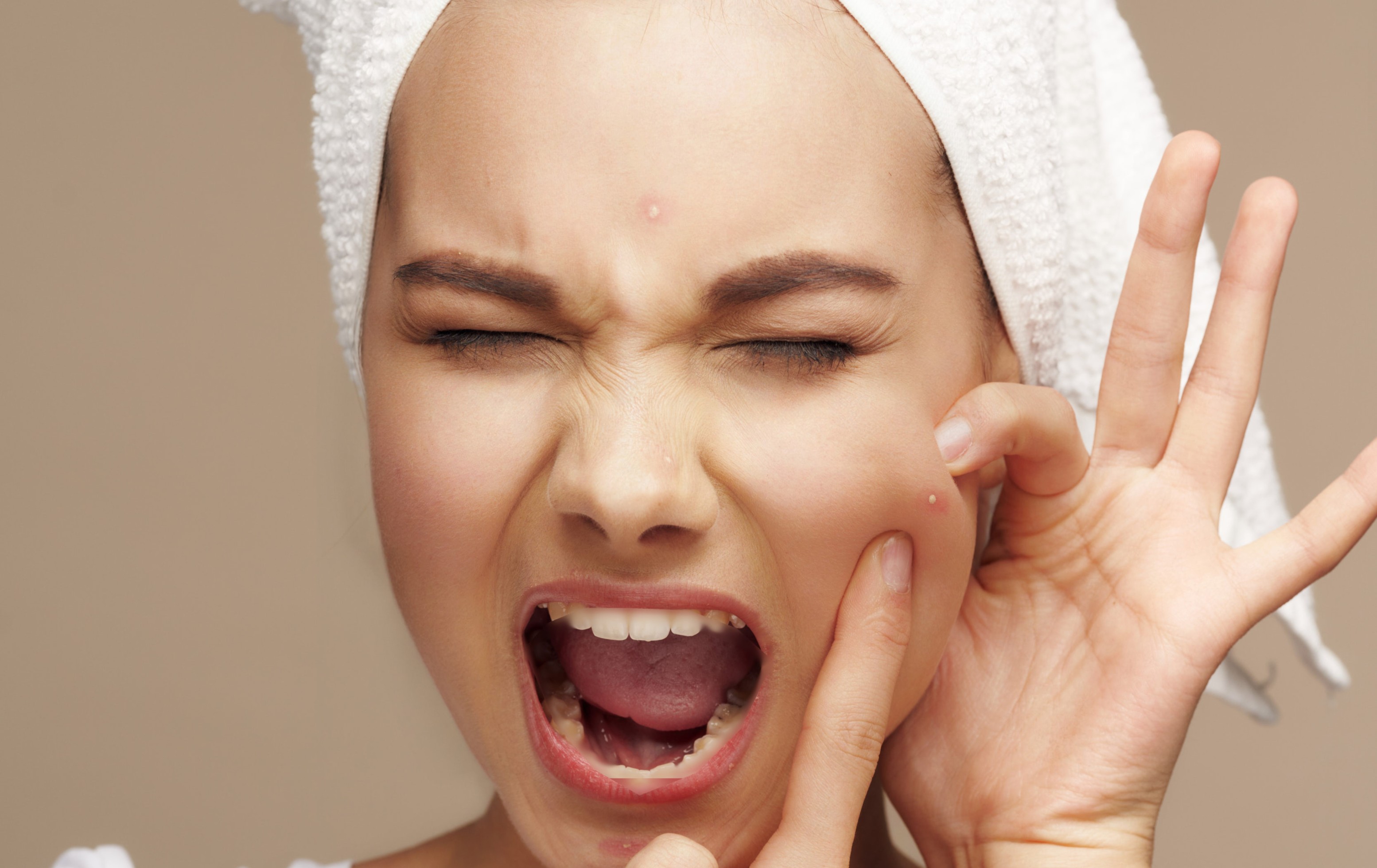 common mistakes people make during acne treatment